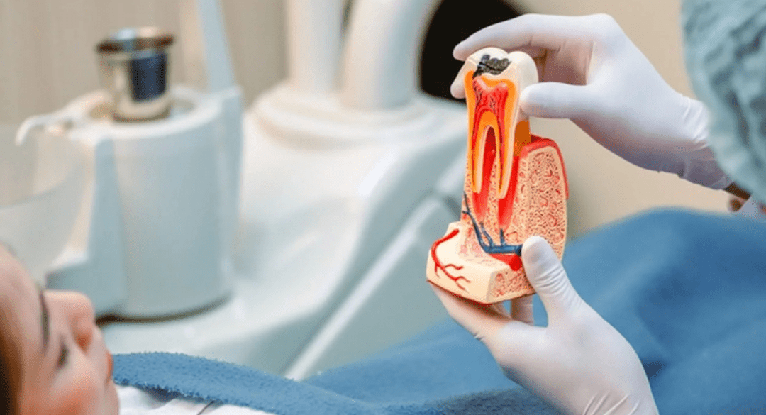 Endodonti